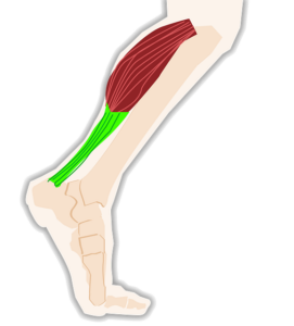 Que Faire en Cas de Douleurs au Mollet ? Causes et Traitements